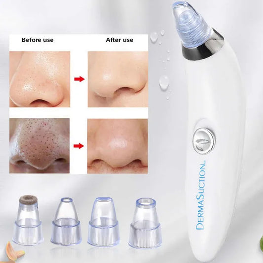 5-in-1 Blackhead Remover Tool: Deep Cleanse & Refine Pores for Glowing Skin
